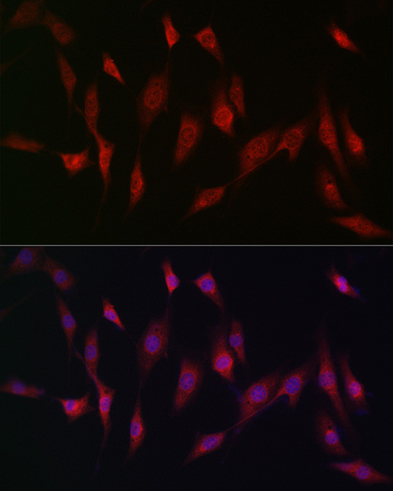 MSRA Antibody in Immunocytochemistry (ICC/IF)
