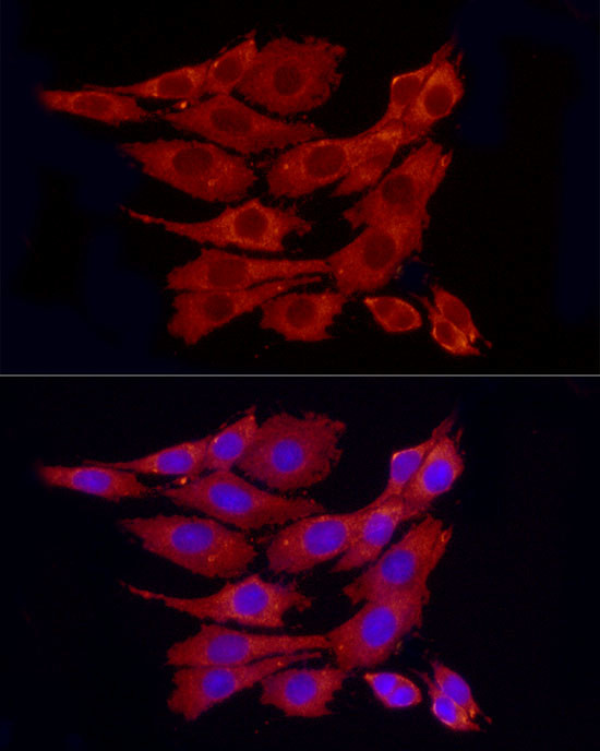 PP1 alpha Antibody in Immunocytochemistry (ICC/IF)