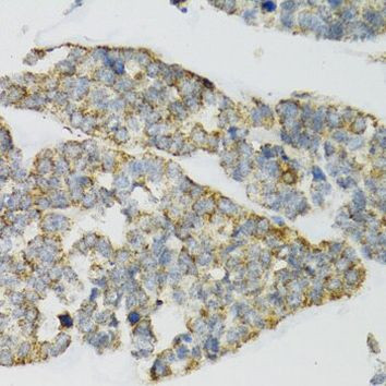 PI3 Antibody in Immunohistochemistry (Paraffin) (IHC (P))