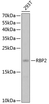 RBP2 Antibody in Western Blot (WB)