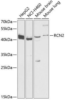 RCN2 Antibody in Western Blot (WB)