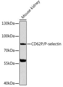 P-Selectin Antibody in Western Blot (WB)