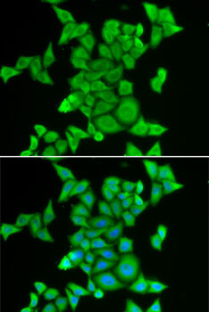 STRN3 Antibody in Immunocytochemistry (ICC/IF)