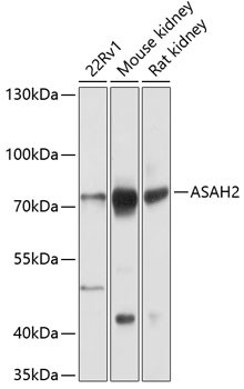 ASAH2 Antibody in Western Blot (WB)
