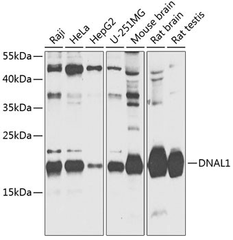 DNAL1 Antibody in Western Blot (WB)