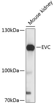 EVC Antibody in Western Blot (WB)