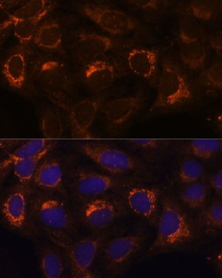 HIBADH Antibody in Immunocytochemistry (ICC/IF)