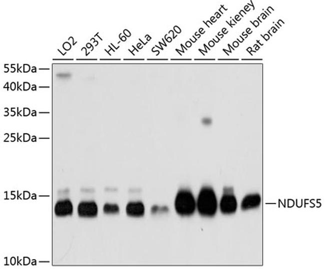 NDUFS5 Antibody in Western Blot (WB)