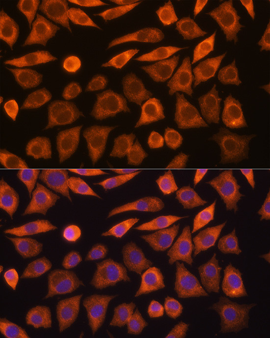 GUCY1A3 Antibody in Immunocytochemistry (ICC/IF)