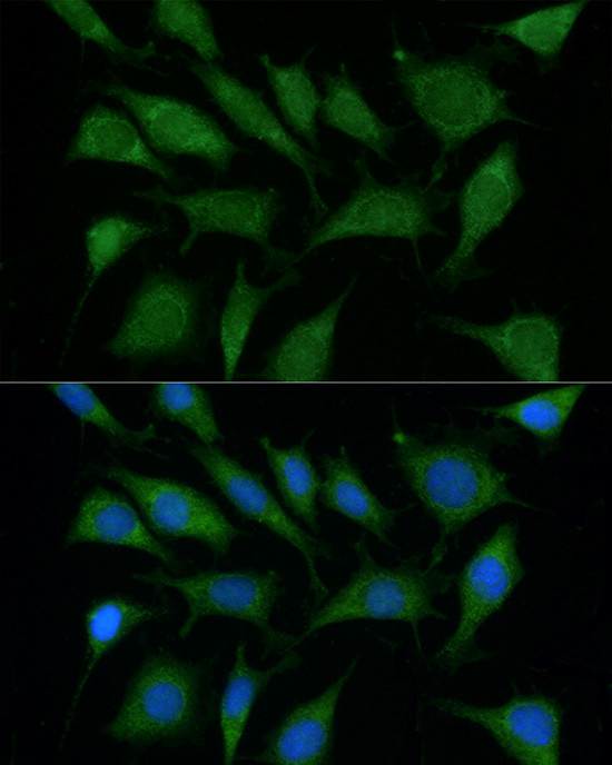 TRIM45 Antibody in Immunocytochemistry (ICC/IF)