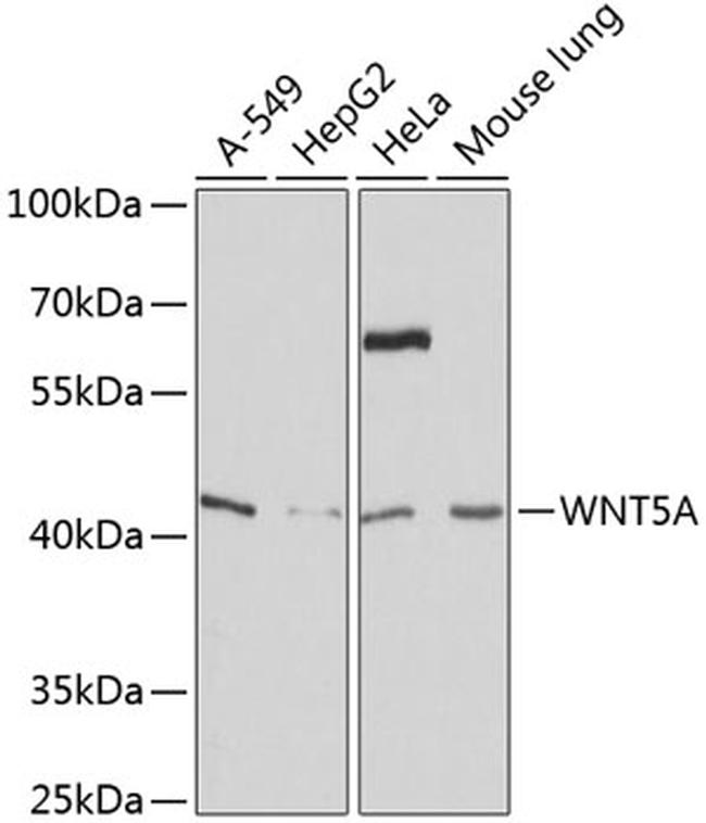 WNT5A Polyclonal Antibody (PA588735)