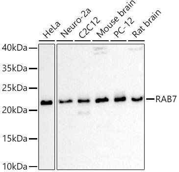 RAB7A Antibody in Western Blot (WB)