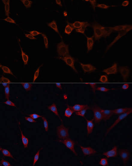 PDIA2 Antibody in Immunocytochemistry (ICC/IF)