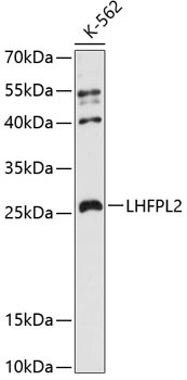 LHFPL2 Antibody in Western Blot (WB)