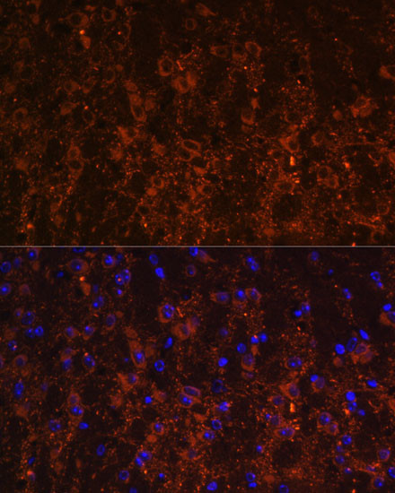 SNX13 Antibody in Immunohistochemistry (Paraffin) (IHC (P))
