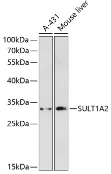 SULT1A2 Antibody in Western Blot (WB)