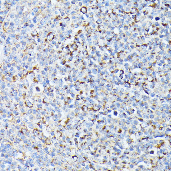 TP53I11 Antibody in Immunohistochemistry (Paraffin) (IHC (P))