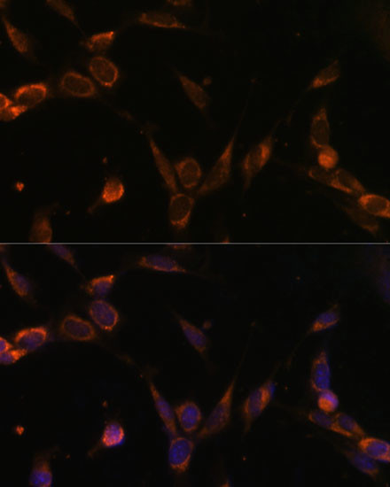 USP30 Antibody in Immunocytochemistry (ICC/IF)