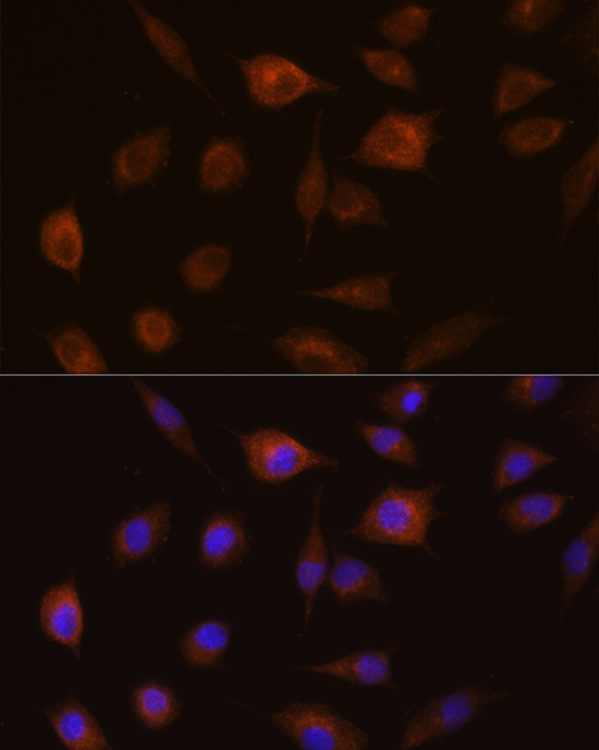 GSTT1 Antibody in Immunocytochemistry (ICC/IF)