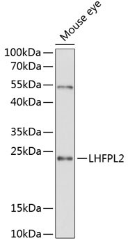 LHFPL2 Antibody in Western Blot (WB)