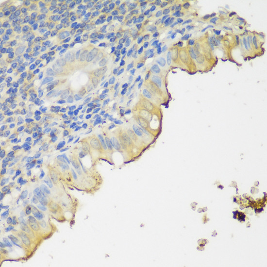 CLN5 Antibody in Immunohistochemistry (Paraffin) (IHC (P))