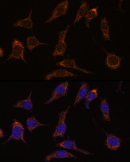 SCGN Antibody in Immunocytochemistry (ICC/IF)