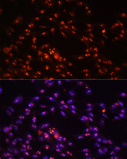 DKC1 Antibody in Immunocytochemistry (ICC/IF)
