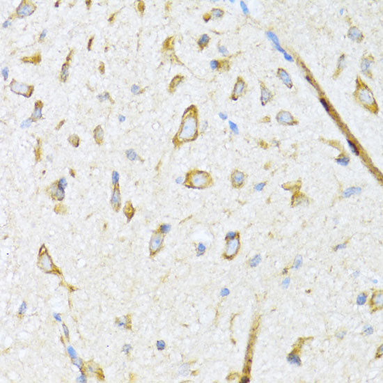 DNAJB11 Antibody in Immunohistochemistry (Paraffin) (IHC (P))