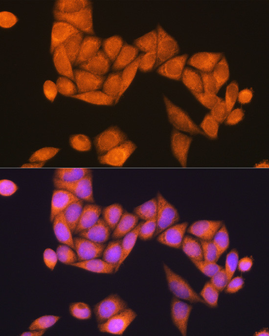 RAP1B Antibody in Immunocytochemistry (ICC/IF)