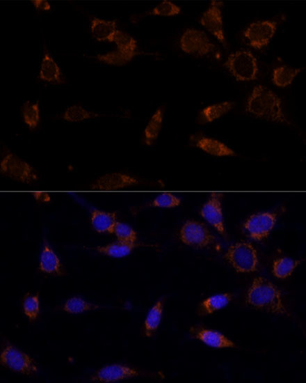 MTCH2 Antibody in Immunocytochemistry (ICC/IF)