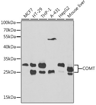 COMT Antibody in Western Blot (WB)