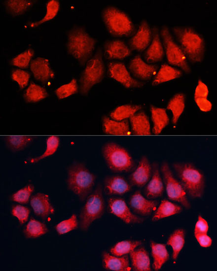 CDK7 Antibody in Immunocytochemistry (ICC/IF)