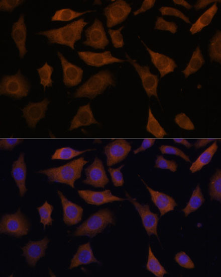 PGK2 Antibody in Immunocytochemistry (ICC/IF)