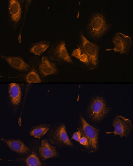 RPL32 Antibody in Immunocytochemistry (ICC/IF)
