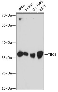 CKAP1 Antibody in Western Blot (WB)