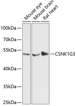 CK1 gamma-3 Antibody in Western Blot (WB)