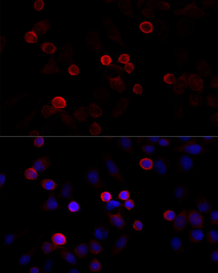 Filamin 2 Antibody in Immunocytochemistry (ICC/IF)