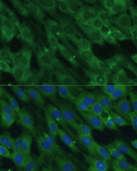 HAL Antibody in Immunocytochemistry (ICC/IF)