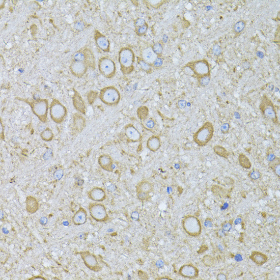 MTNR1A Antibody in Immunohistochemistry (Paraffin) (IHC (P))
