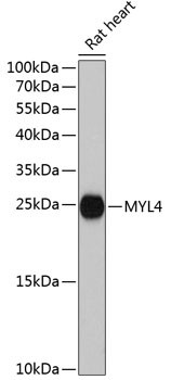 MYL4 Antibody in Western Blot (WB)