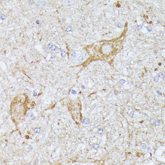 TBCA Antibody in Immunohistochemistry (Paraffin) (IHC (P))