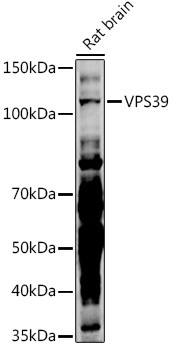 VPS39 Antibody in Western Blot (WB)