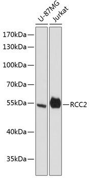 RCC2 Antibody in Western Blot (WB)
