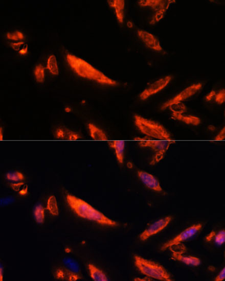 LRRC7 Antibody in Immunocytochemistry (ICC/IF)