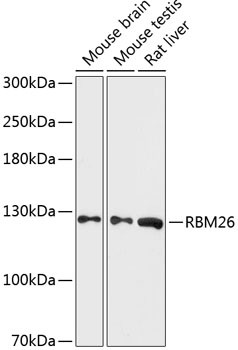 RBM26 Antibody in Western Blot (WB)
