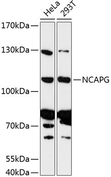 NCAPG Antibody in Western Blot (WB)