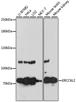 RAD26L Antibody in Western Blot (WB)