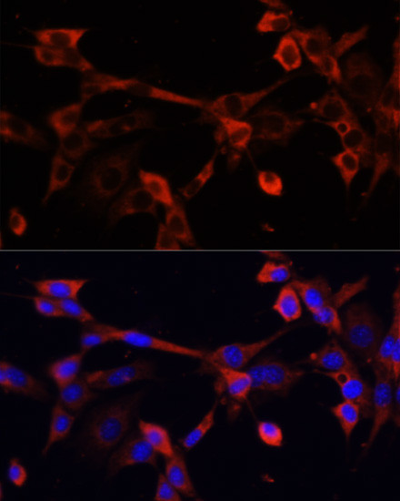 DNASE1L1 Antibody in Immunocytochemistry (ICC/IF)