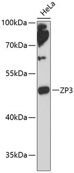 ZP3 Antibody in Western Blot (WB)