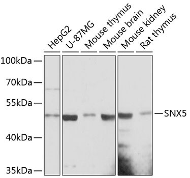 SNX5 Antibody in Western Blot (WB)